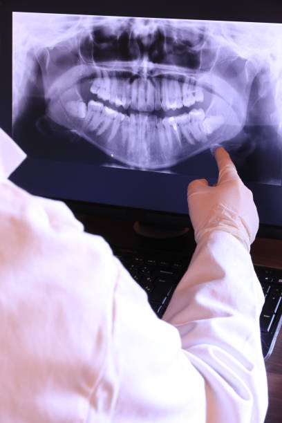 Best Emergency Tooth Extraction in Carlisle, IA