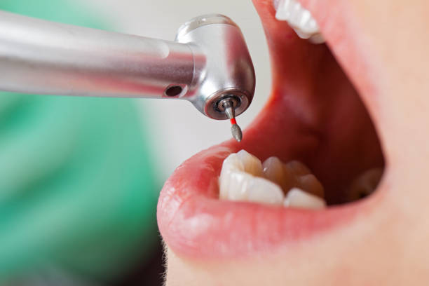Best Pediatric Emergency Dentist in Carlisle, IA
